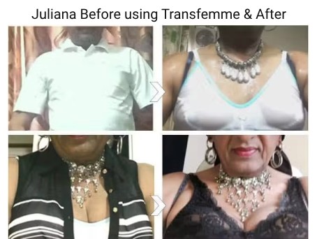 Juliana Before using Transfemme & After