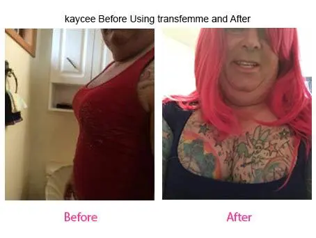 Kaycee Before Using Transfemme and After