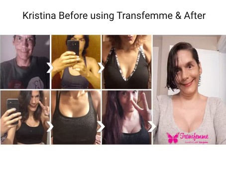 Kristina Before using Transfemme & After