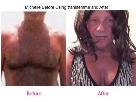 Michelle Before Using Transfemme and After