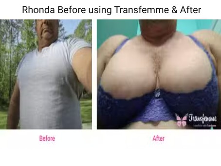 Rhonda Before using Transfemme & After